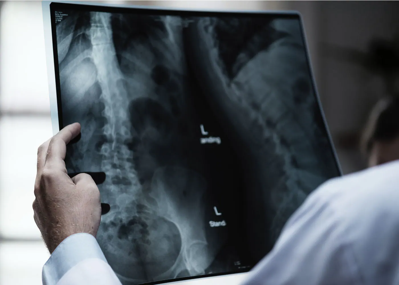 Doctor reviewing a chest X-ray